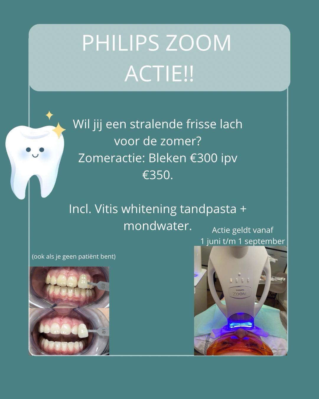 Korting op bleken: voor een zomerse frisse glimlach! 3 - Tandartspraktijk Rijsenhout IMG 3843